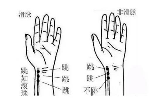 2,怎么摸脉知道没怀孕  如果怀孕了的女性,中医在把脉的时候无名指