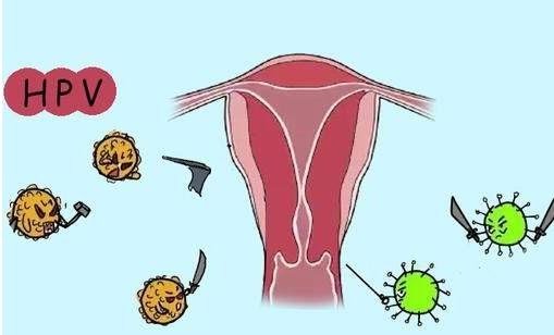 HPV初期小红点照片，在这4个部位的话要提高警惕