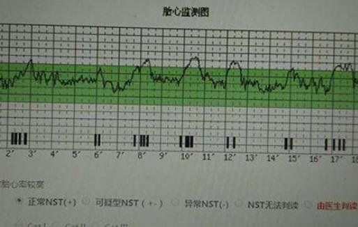 怀男孩很早就有感觉，5种怀儿子最明显的征兆