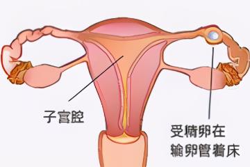 8个征兆说明你宫外孕了，腹痛和阴道出血是最常见的症状