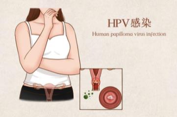 HPV初期小红点照片，4张照片说明hpv小红点特征